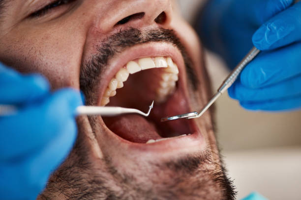 Best Dentist for Severe Toothache  in West Brattleboro, VT