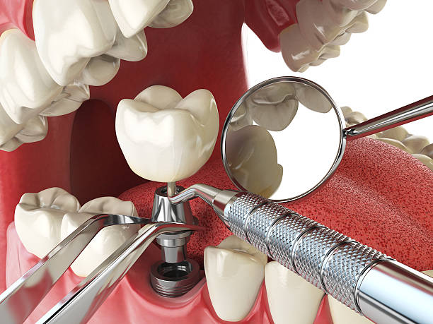 Best Knocked-Out Tooth Emergency  in West Brattleboro, VT