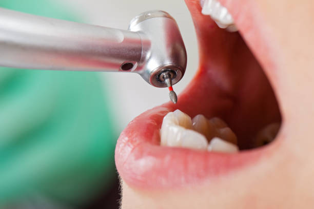Best Tooth Infection Emergency Dentist  in West Brattleboro, VT